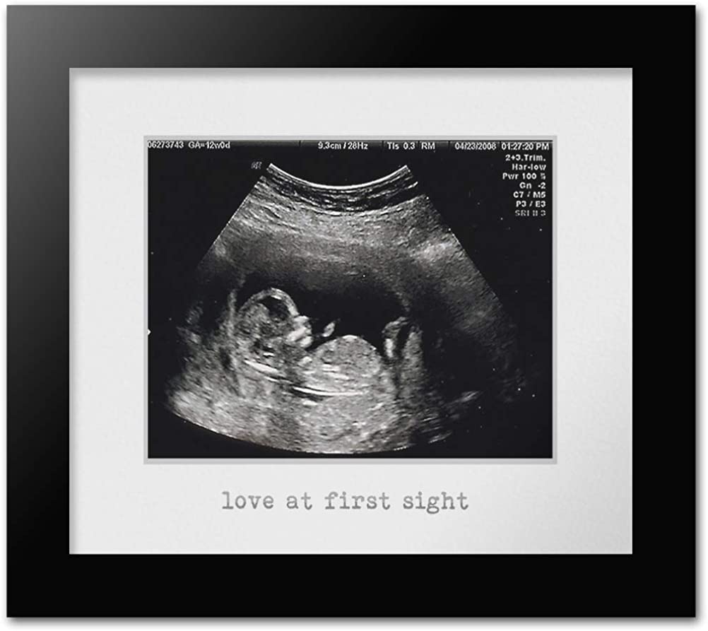 Sonogram Picture frame by Daft Baby